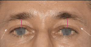brow2