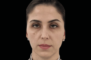 face 1