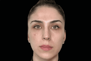 face 2